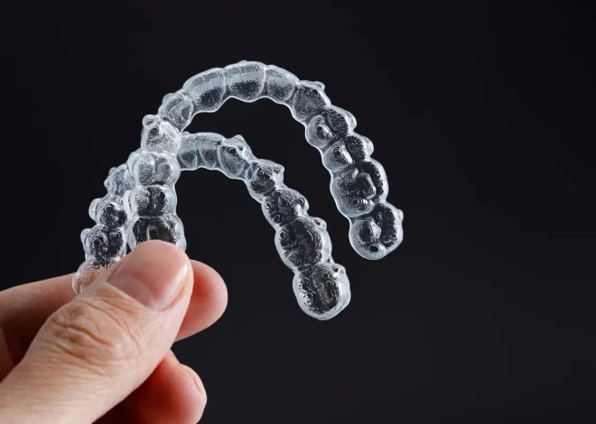 Aparat nakładkowy Invisalign Warszawa