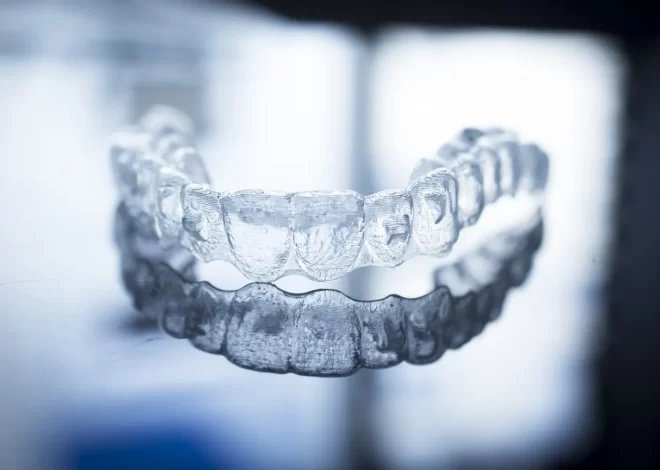 Invisalign Warszawa cena