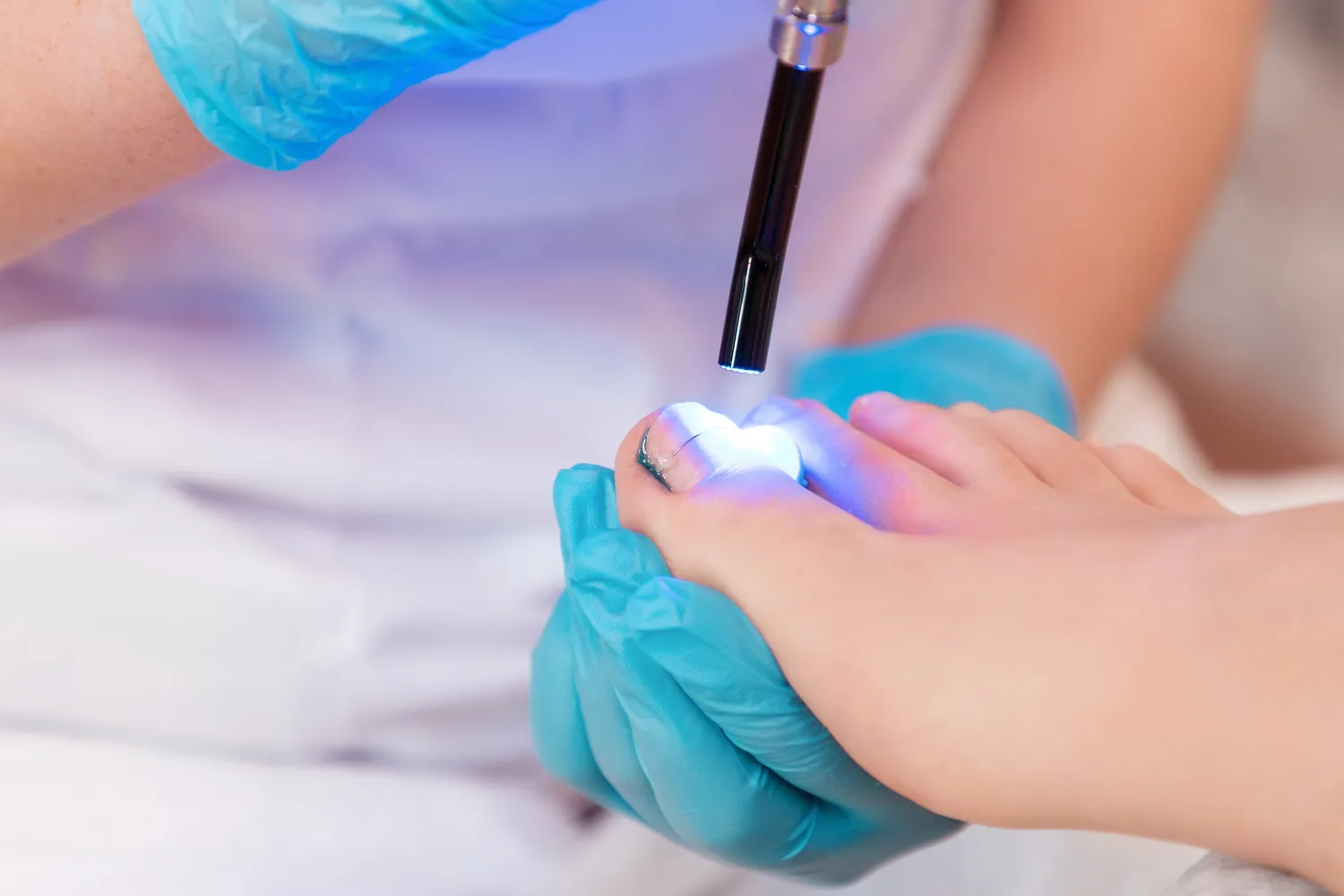 Pedicure leczniczy – czym jest i na jakie efekty możesz liczyć?